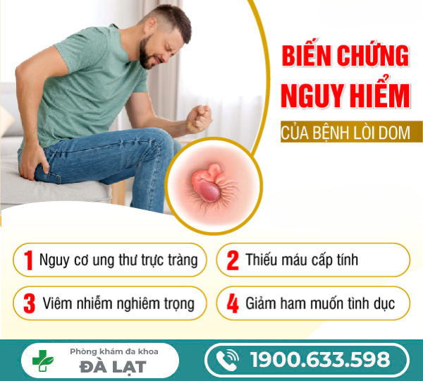 Hình ảnh minh họa